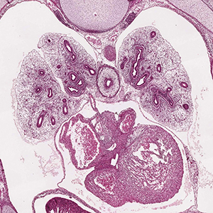 A histology section of a human embryo