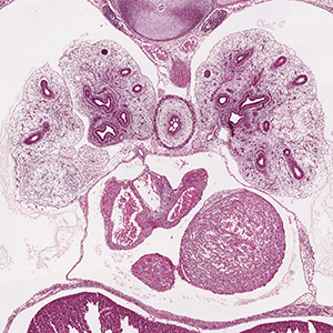 A histology section of a human embryo