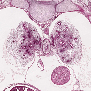 A histology section of a human embryo