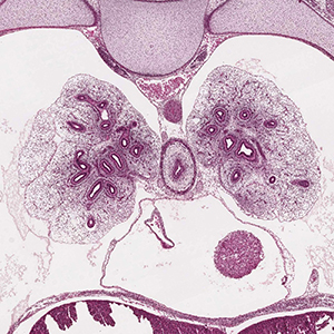 A histology section of a human embryo