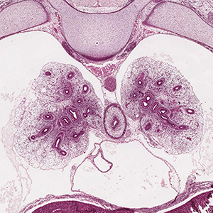 A histology section of a human embryo