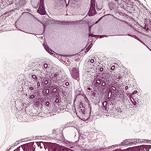 A histology section of a human embryo