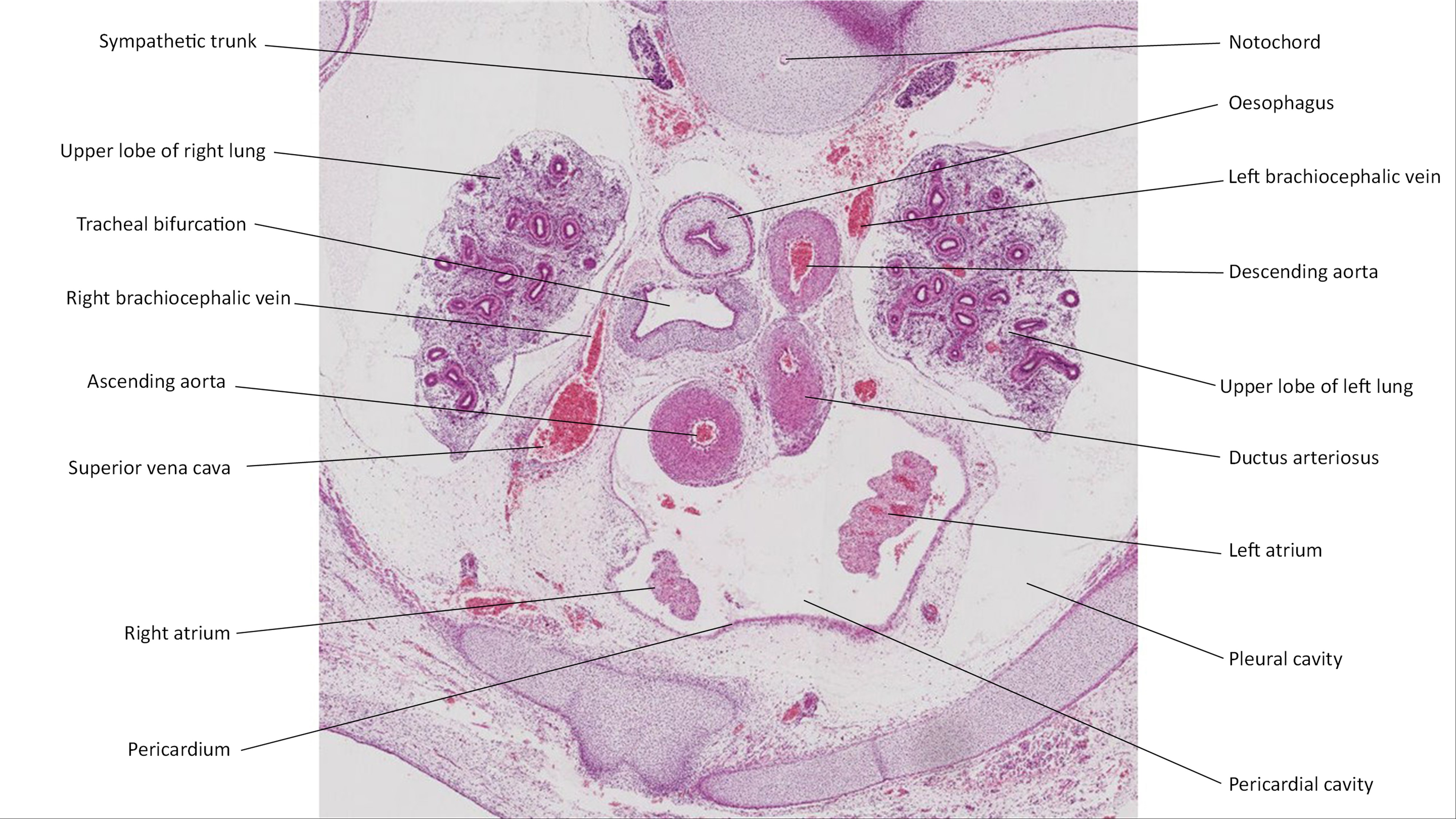 A histology section of a human embryo
