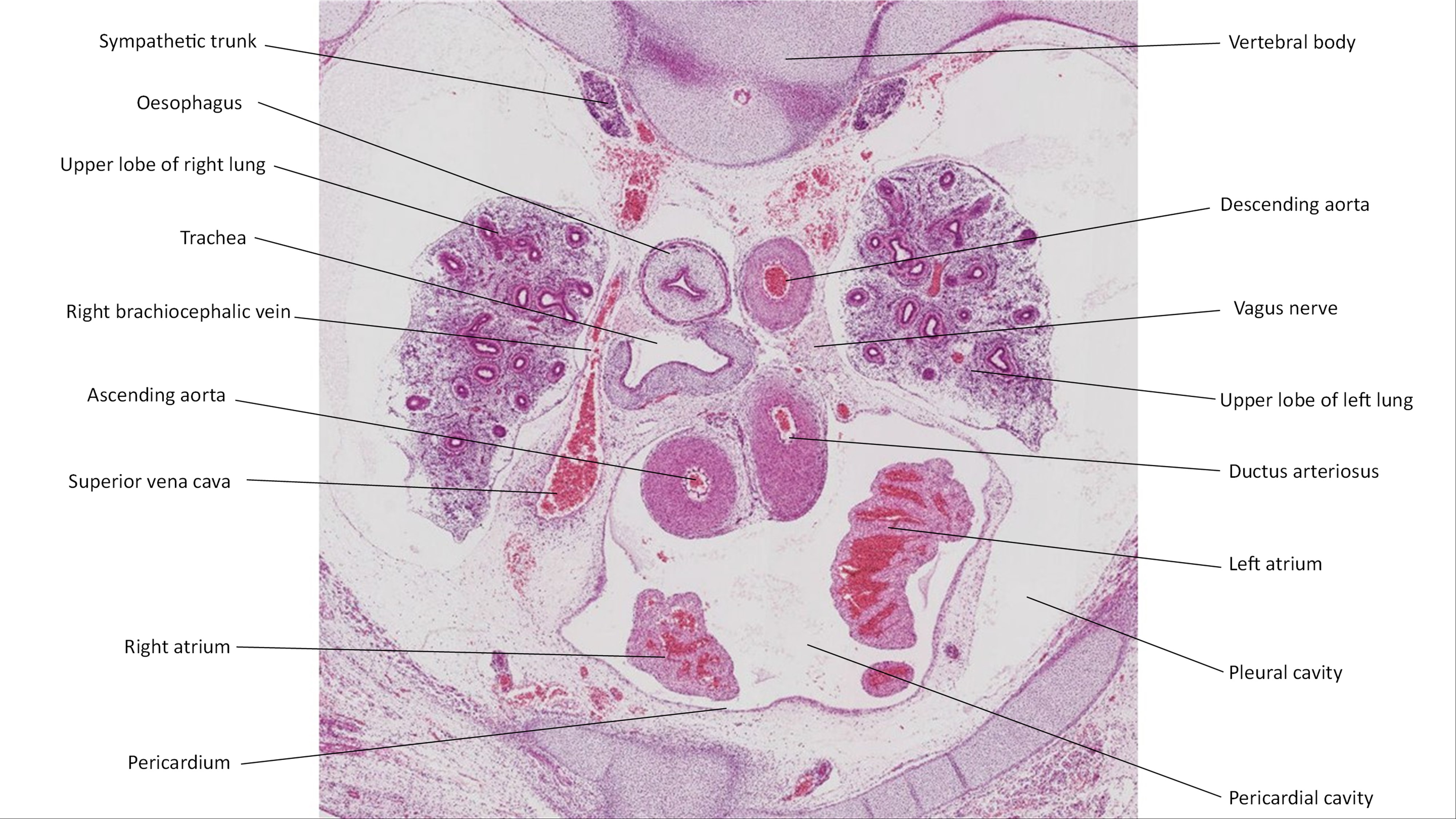 A histology section of a human embryo