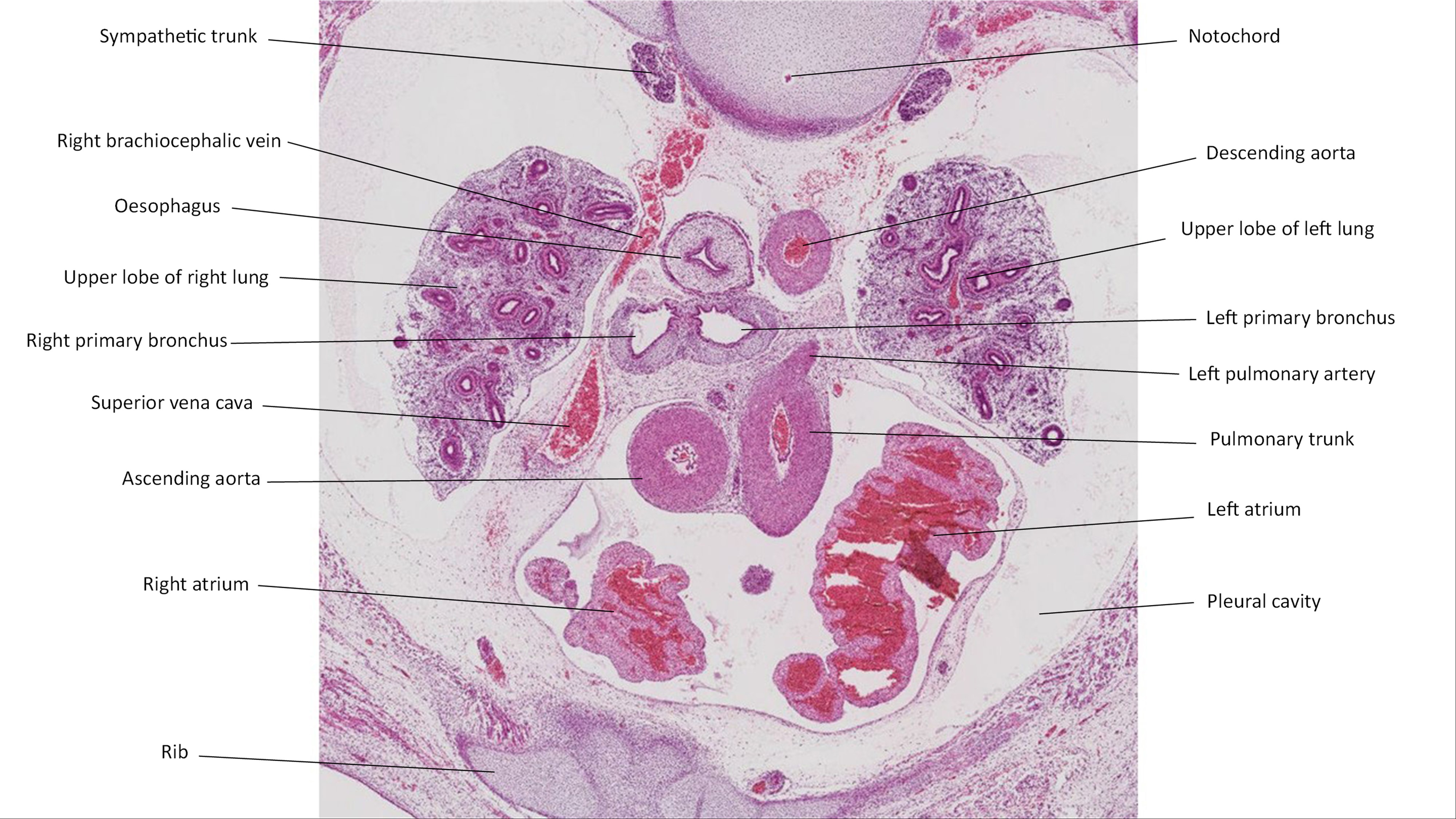 A histology section of a human embryo
