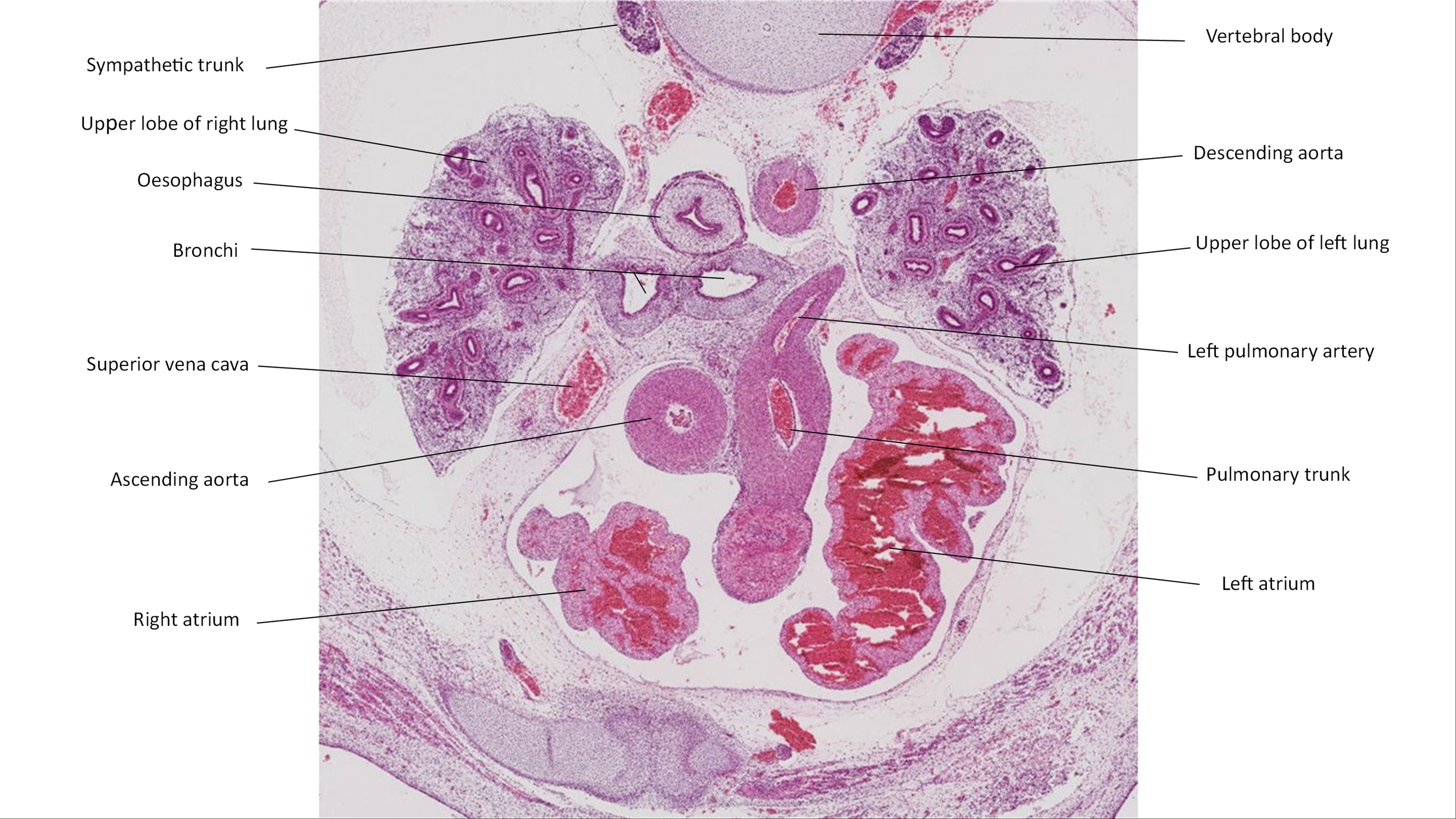 A histology section of a human embryo