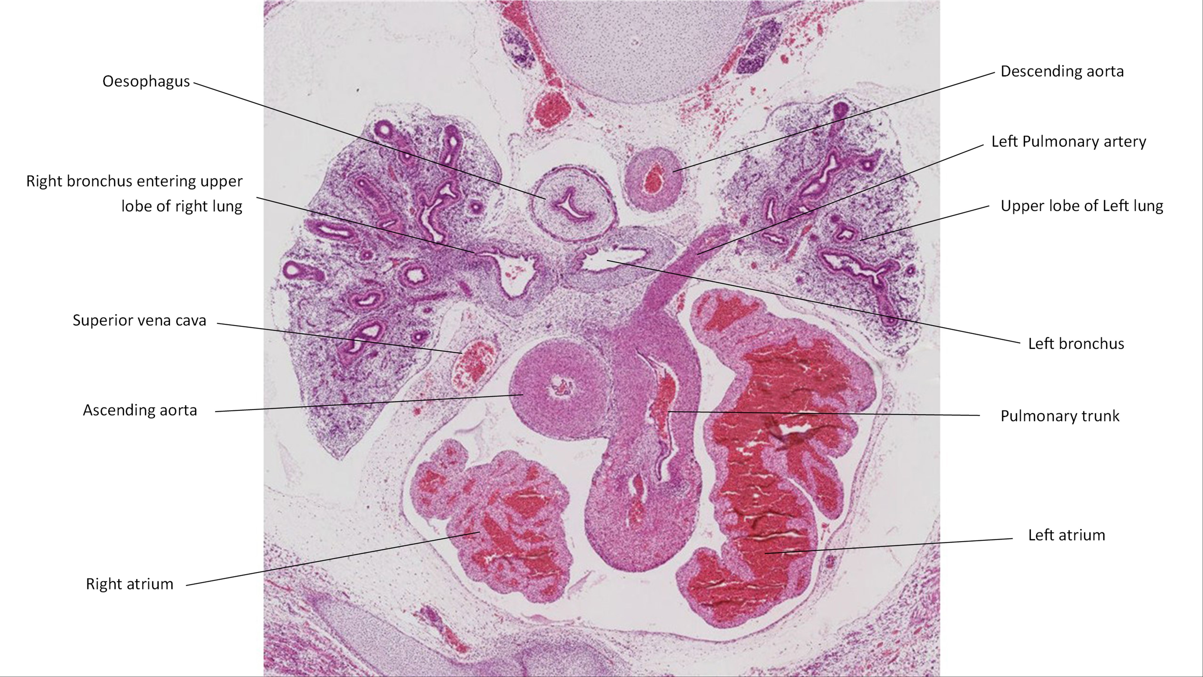 A histology section of a human embryo