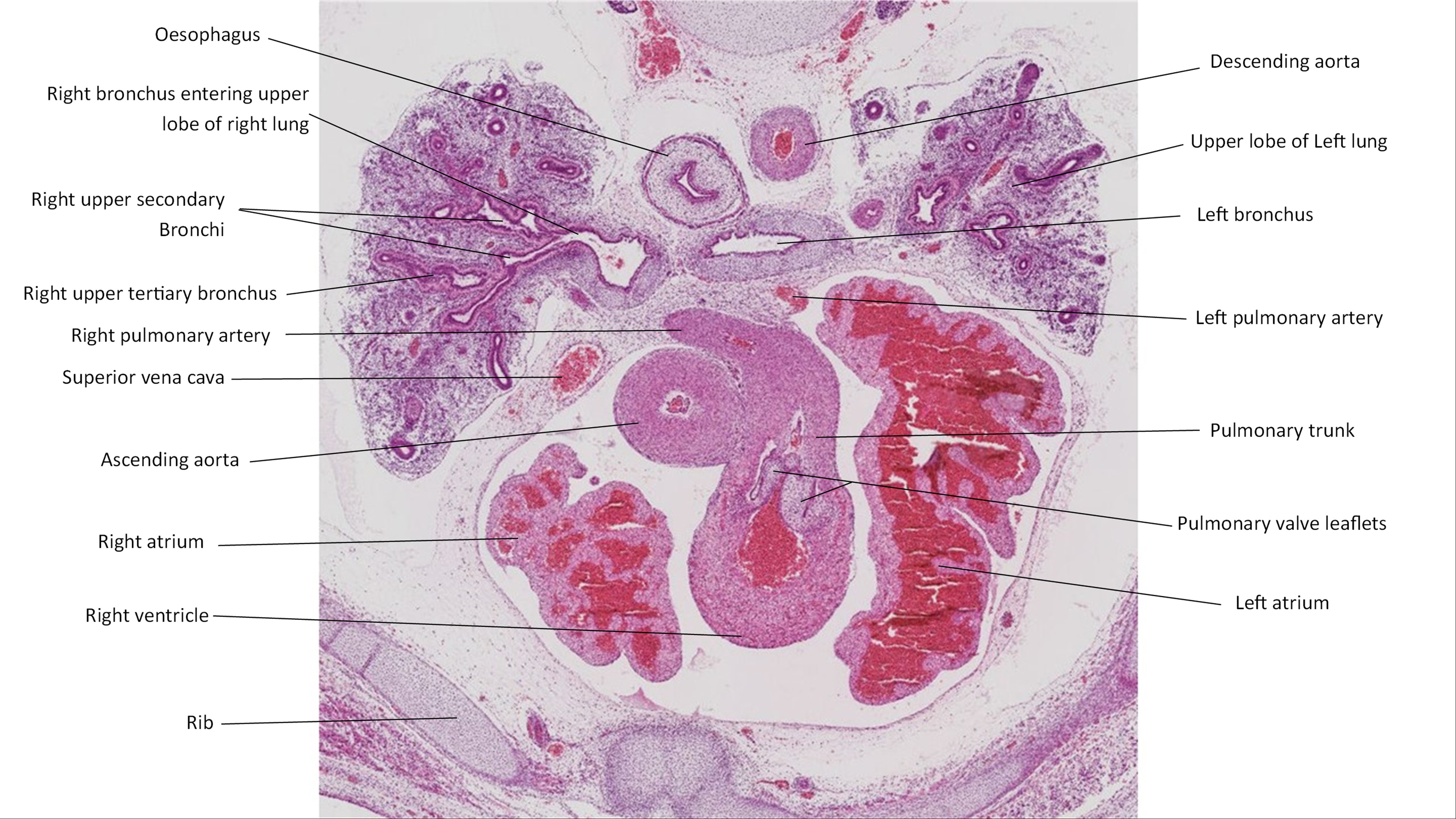 A histology section of a human embryo