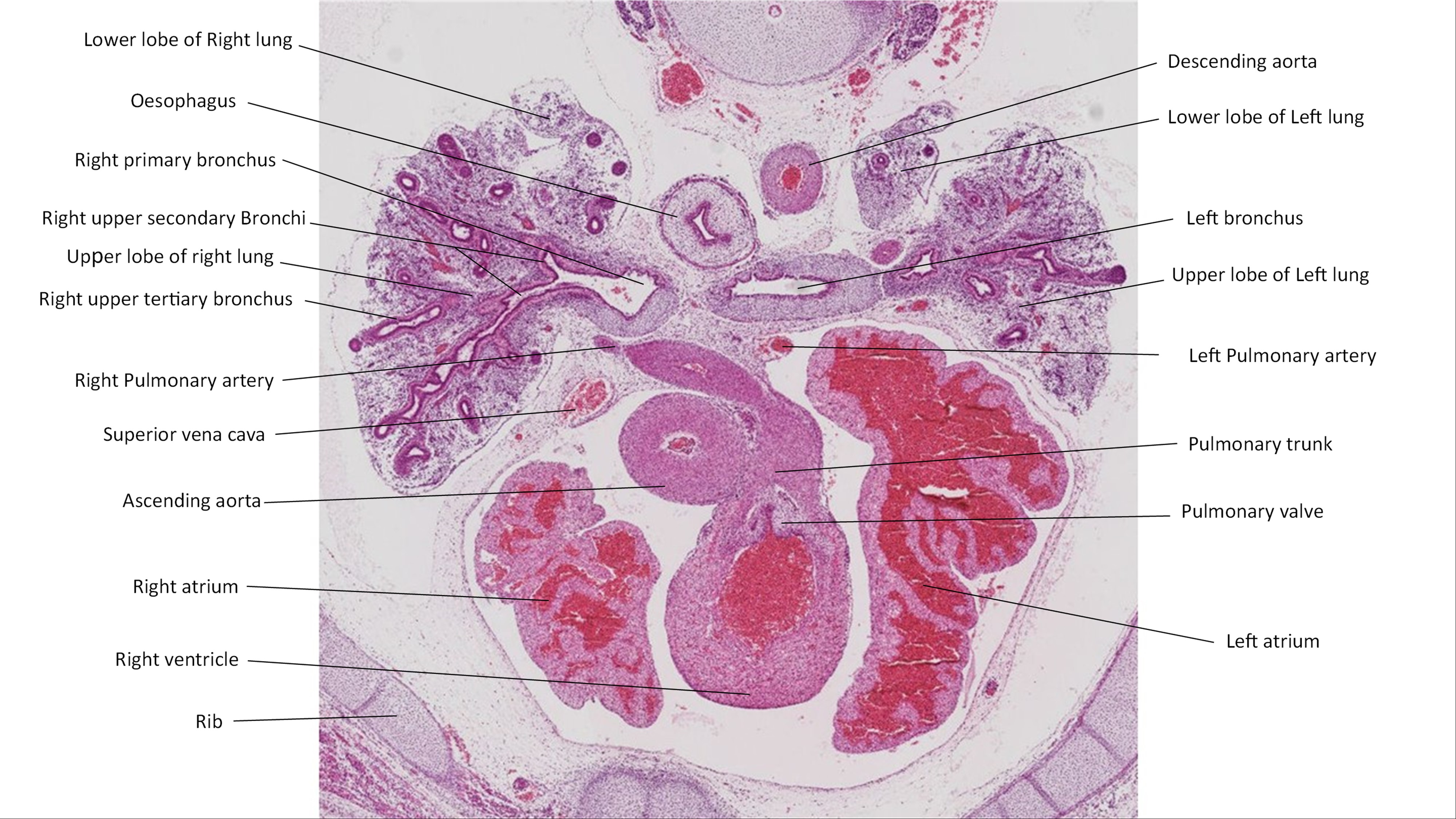 A histology section of a human embryo