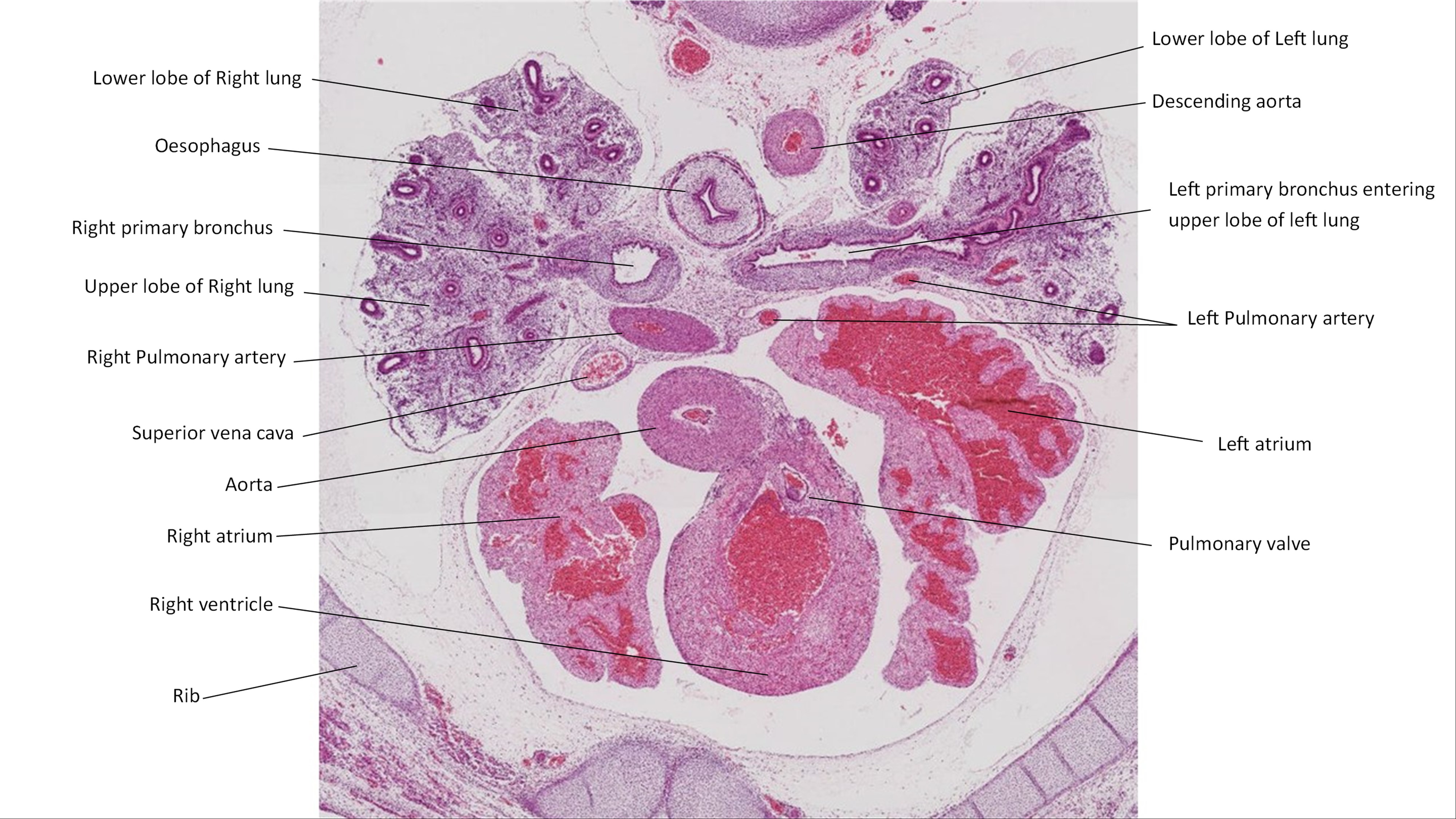 A histology section of a human embryo