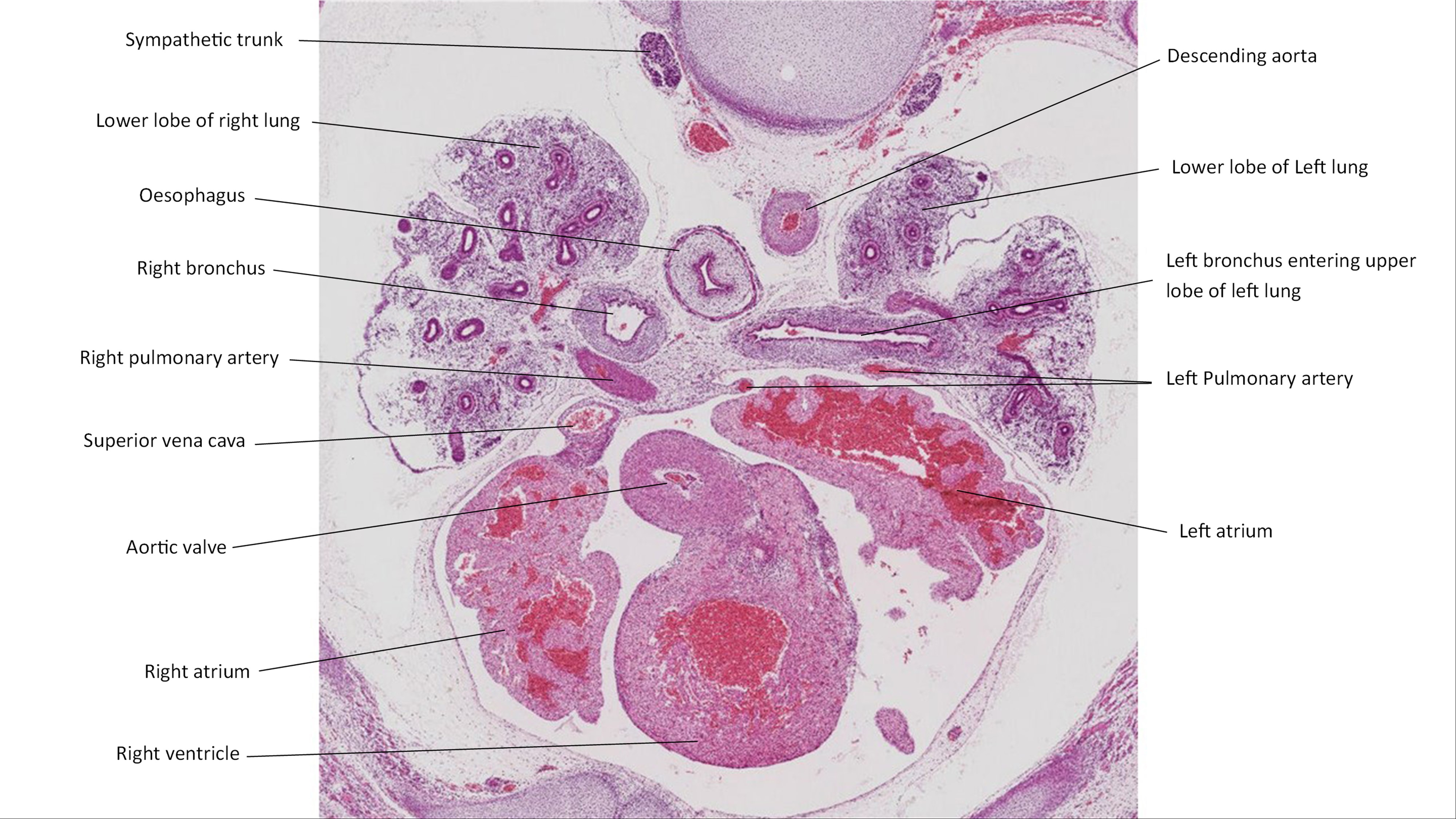 A histology section of a human embryo