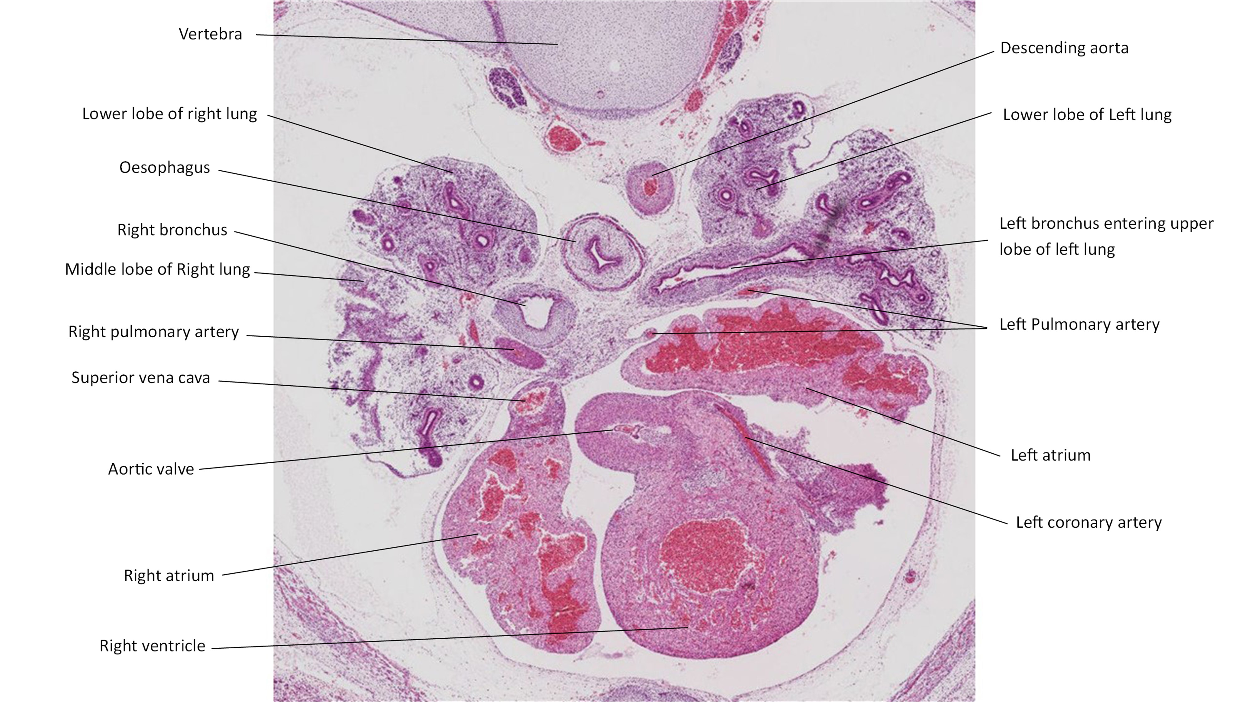 A histology section of a human embryo