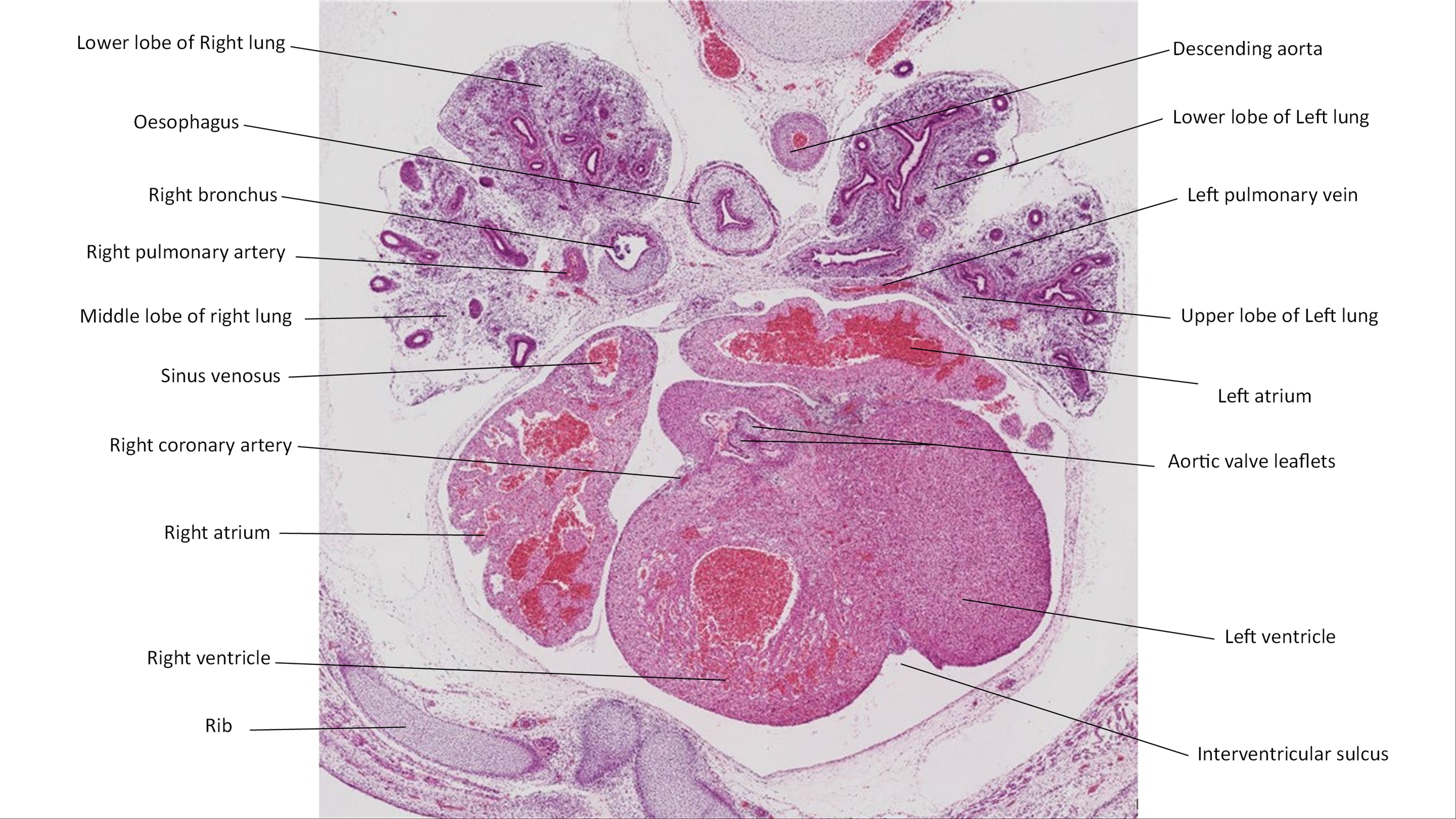 A histology section of a human embryo