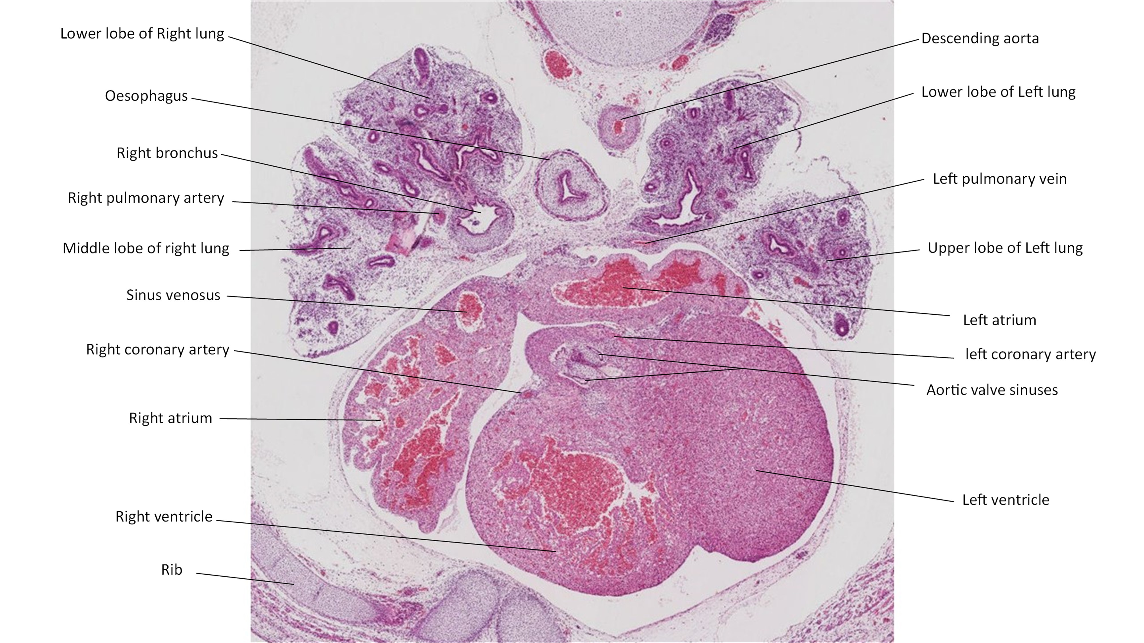 A histology section of a human embryo