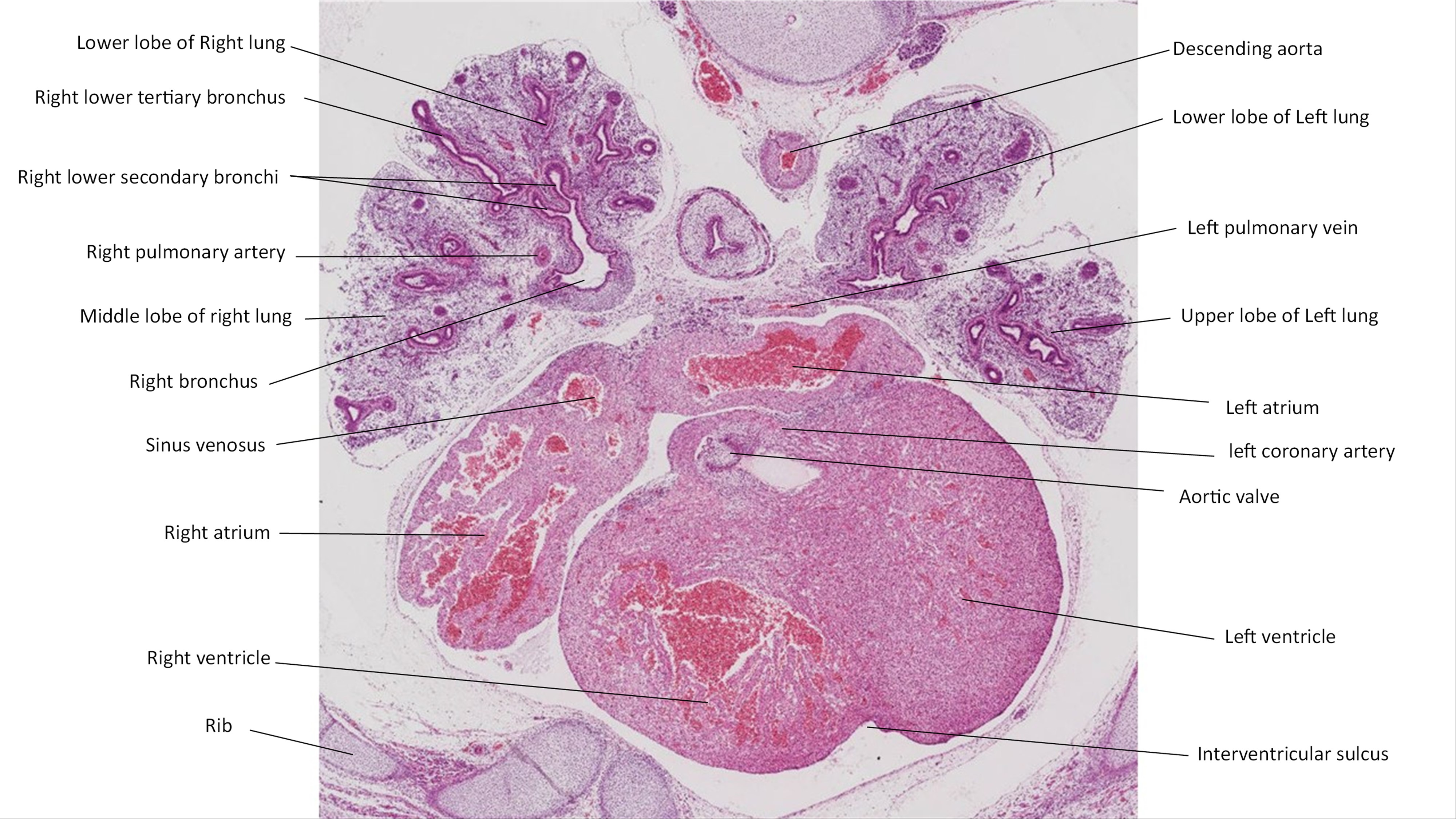 A histology section of a human embryo