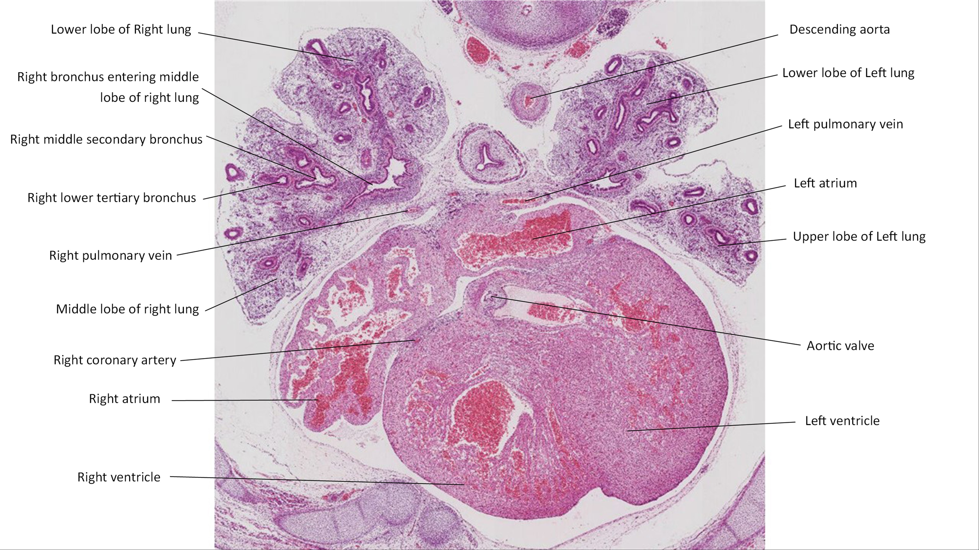 A histology section of a human embryo