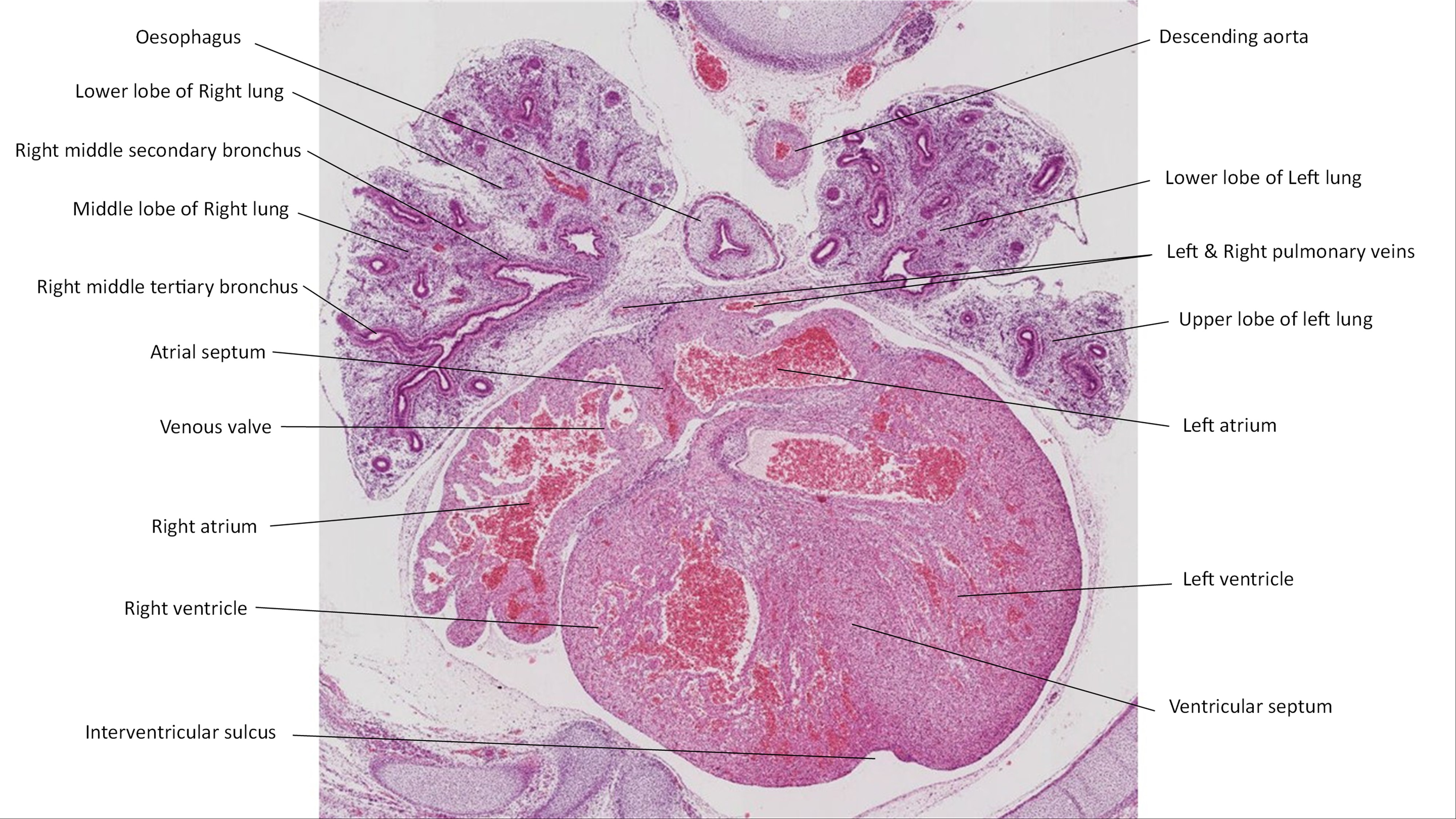 A histology section of a human embryo