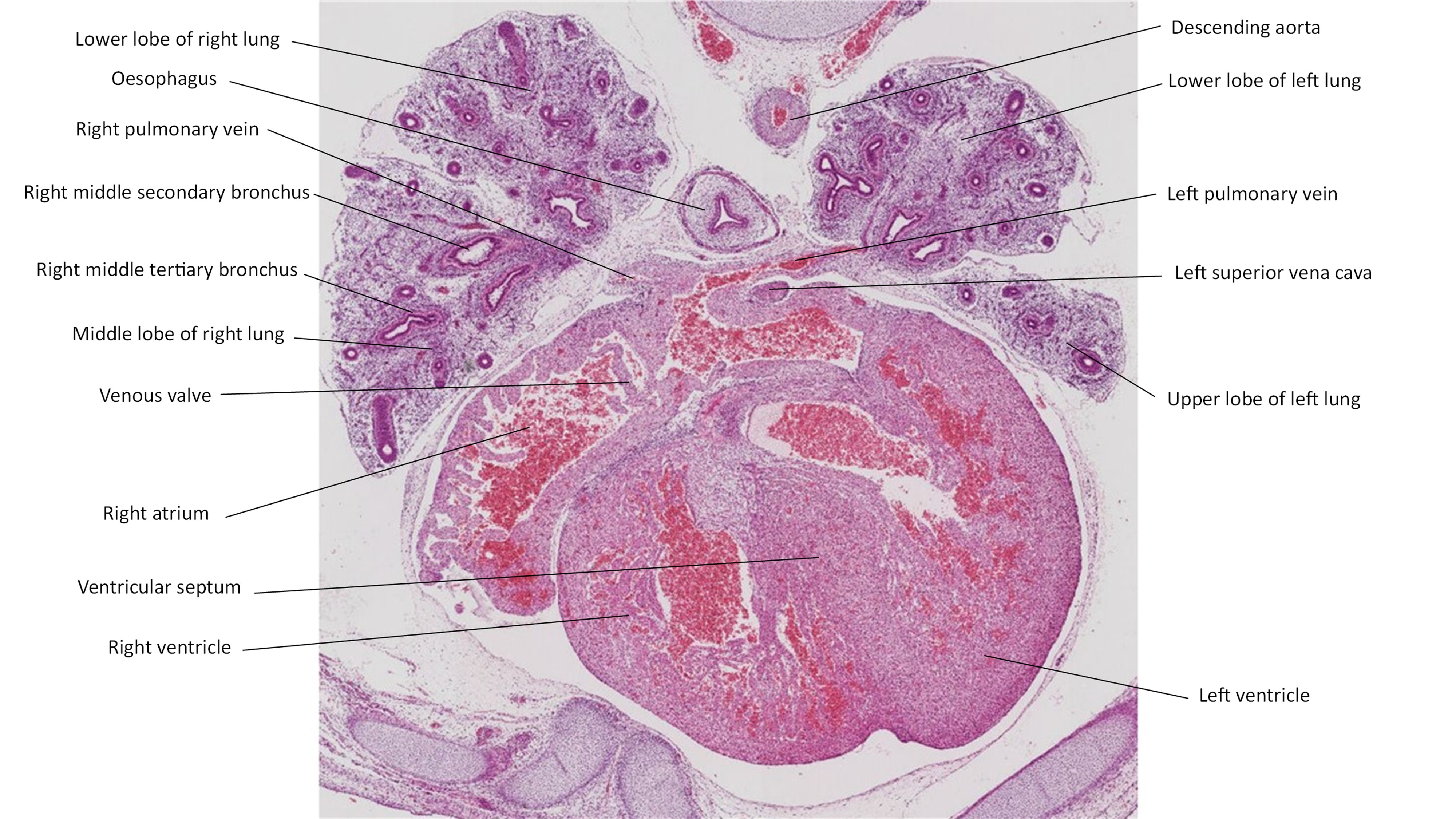 A histology section of a human embryo