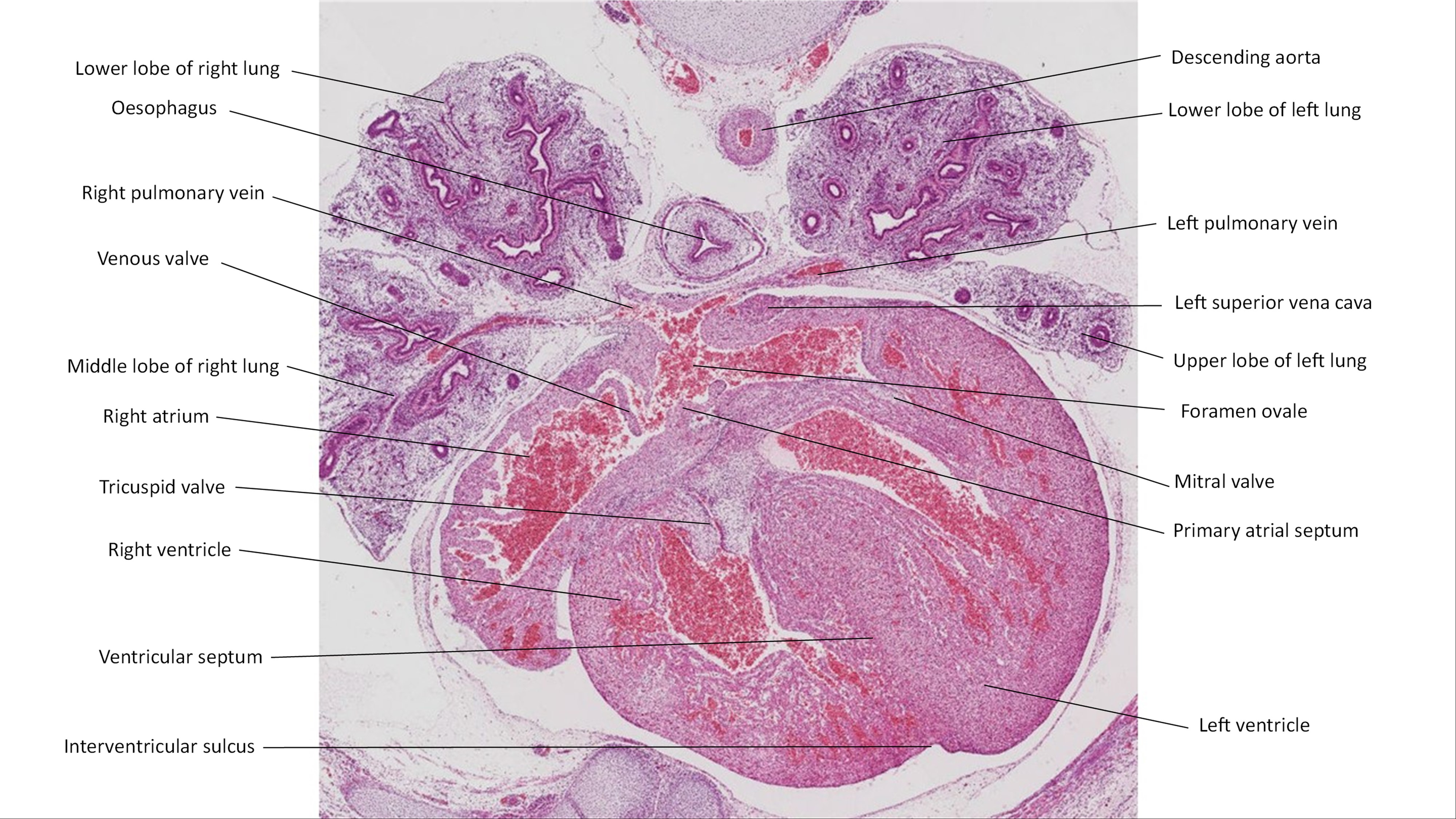 A histology section of a human embryo