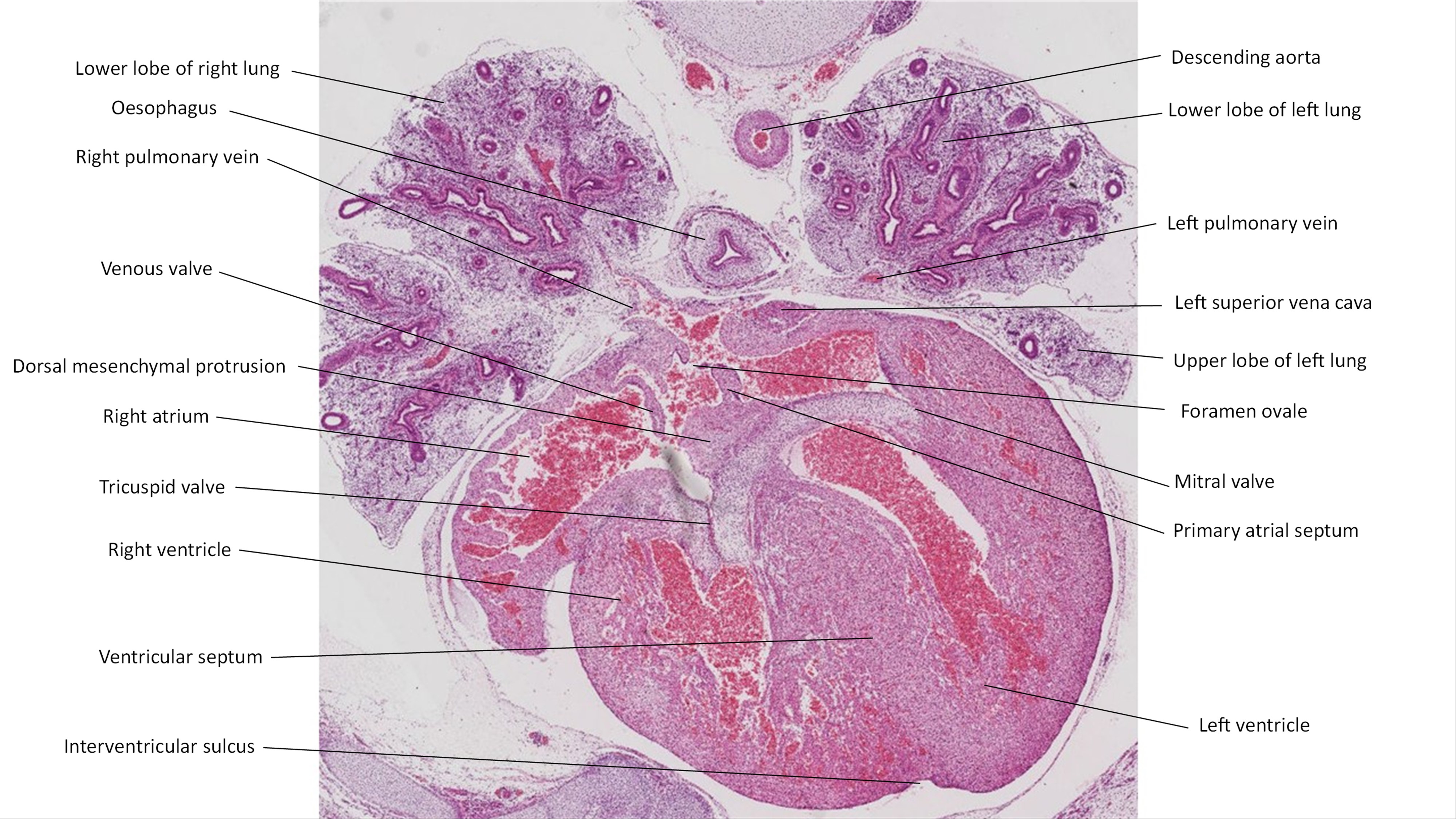 A histology section of a human embryo