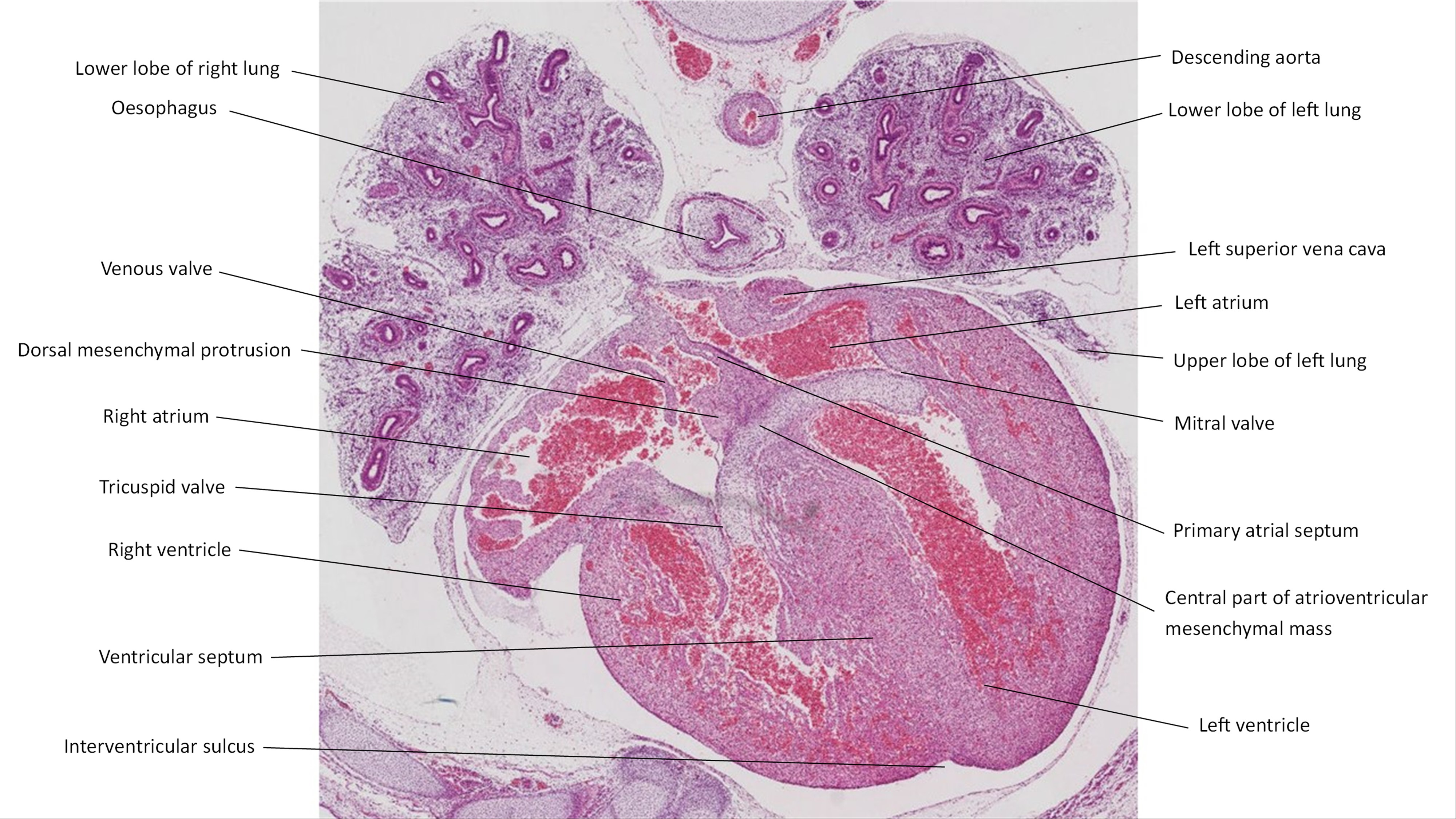 A histology section of a human embryo