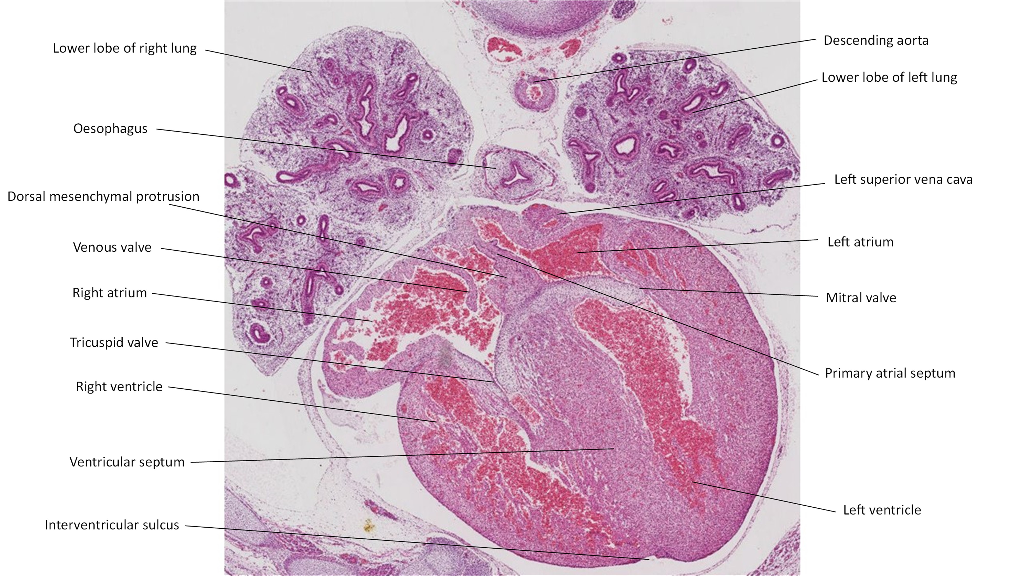 A histology section of a human embryo
