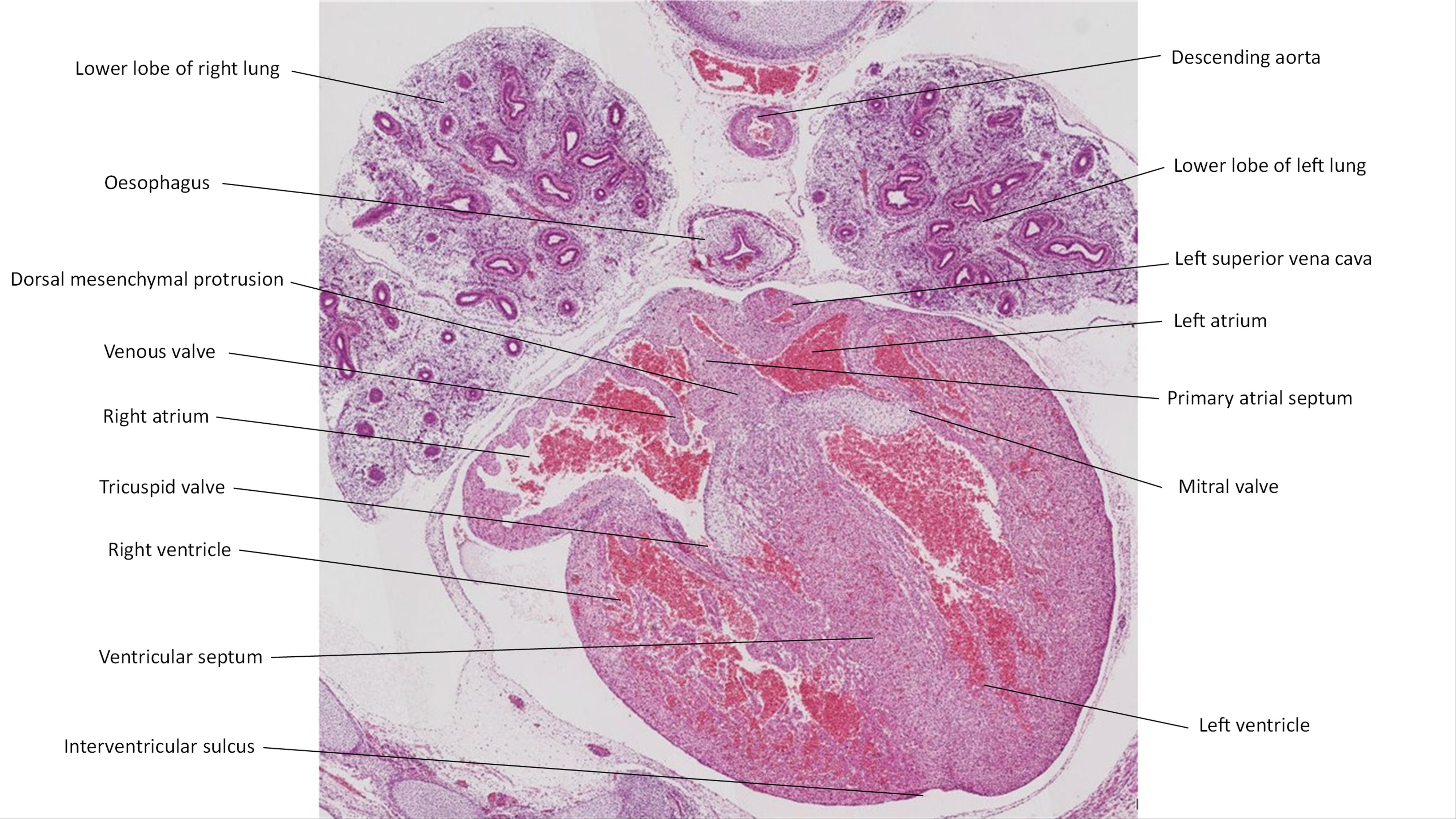 A histology section of a human embryo