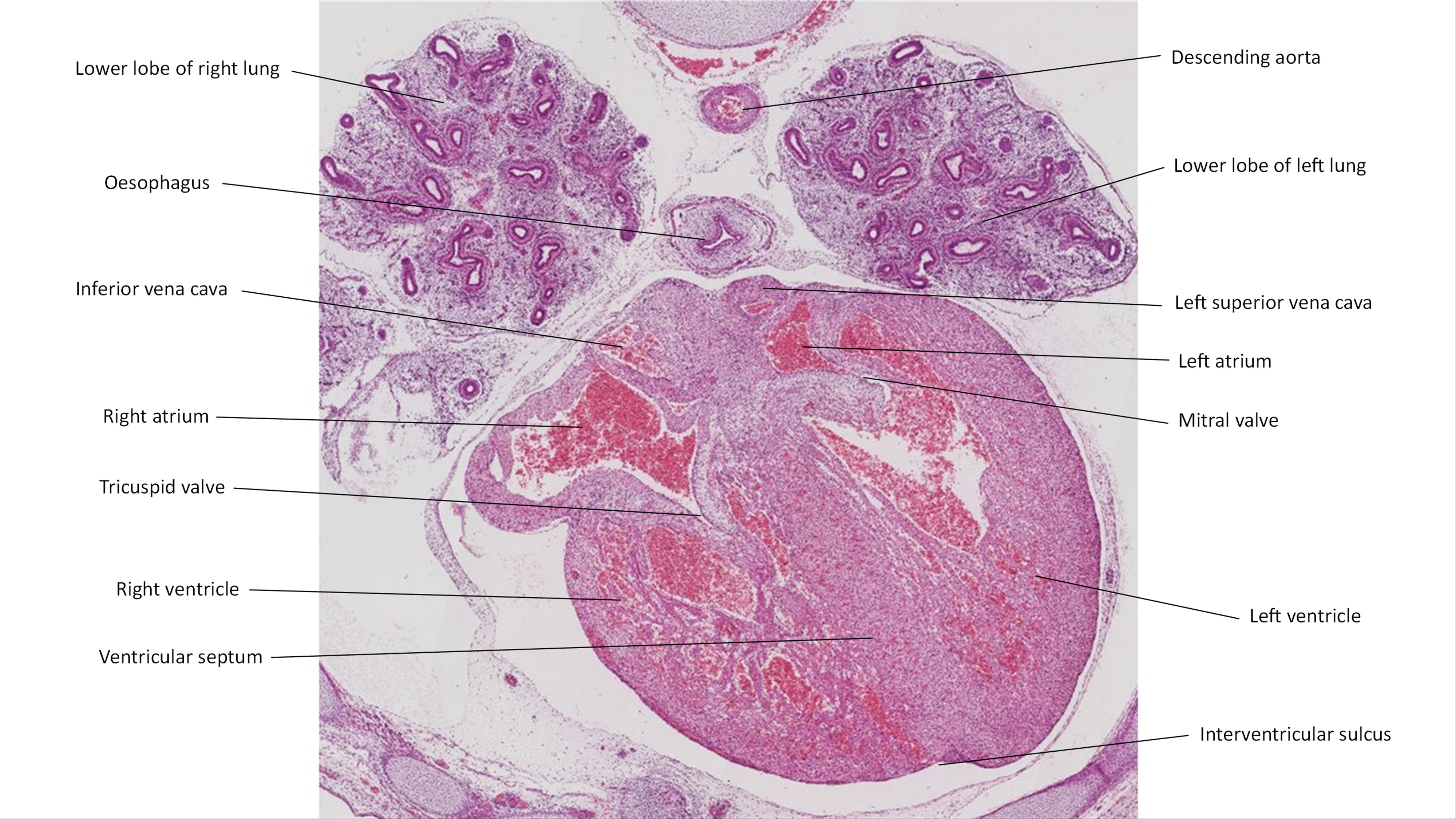 A histology section of a human embryo