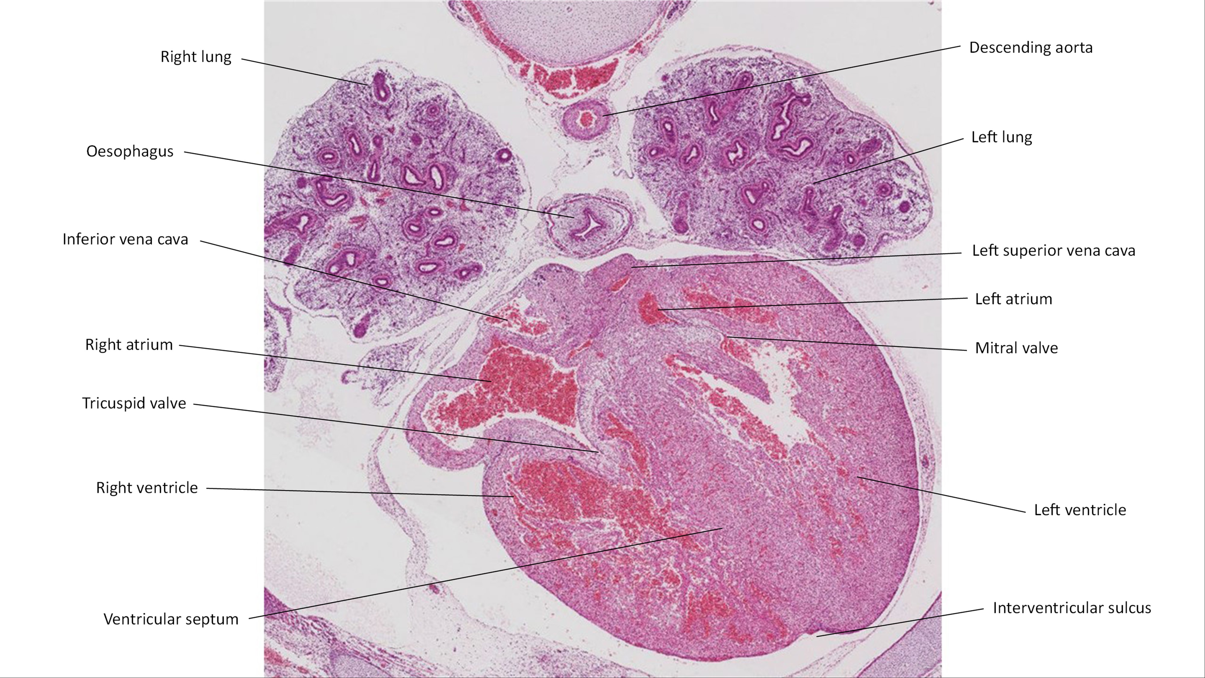 A histology section of a human embryo