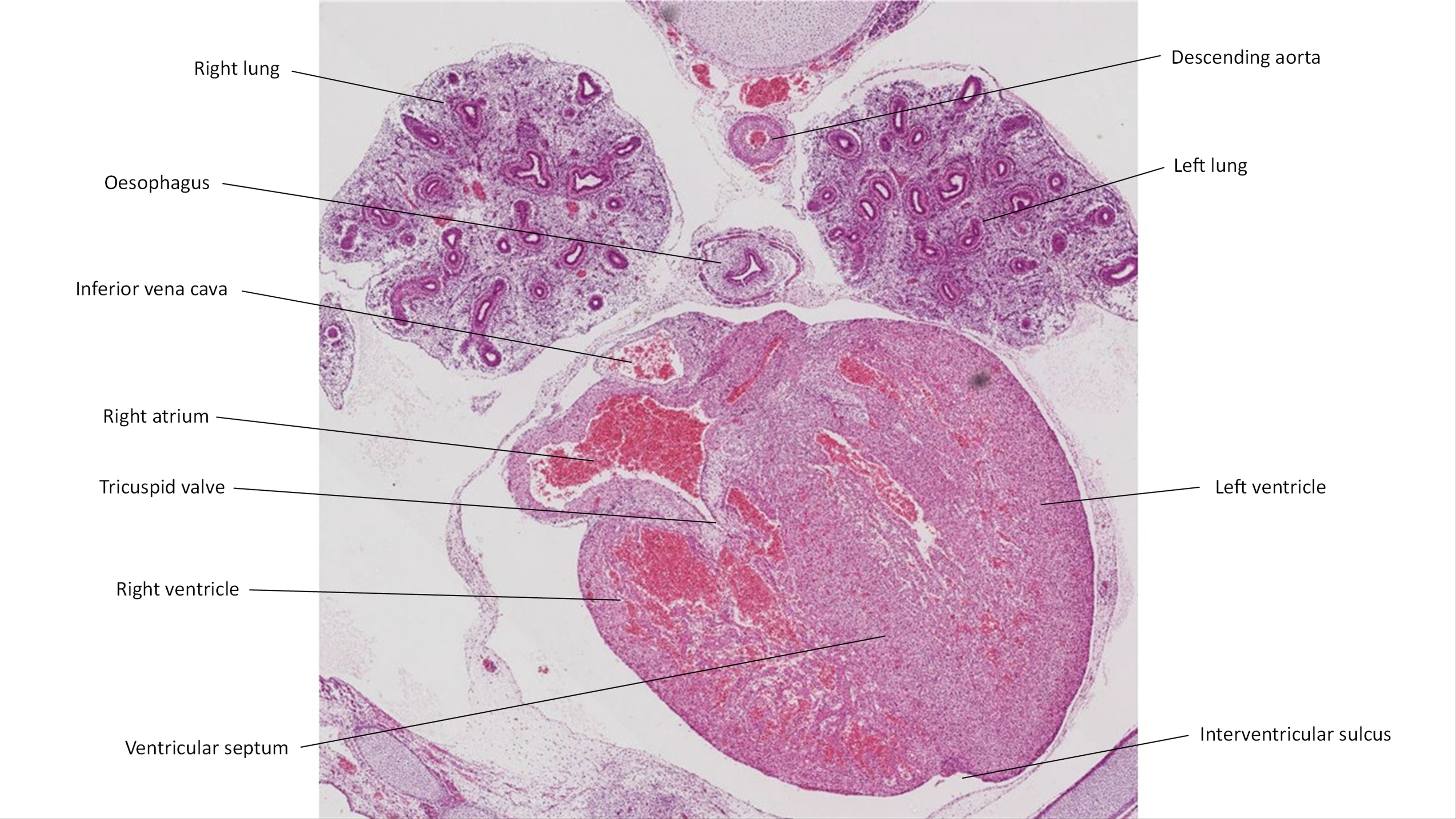 A histology section of a human embryo