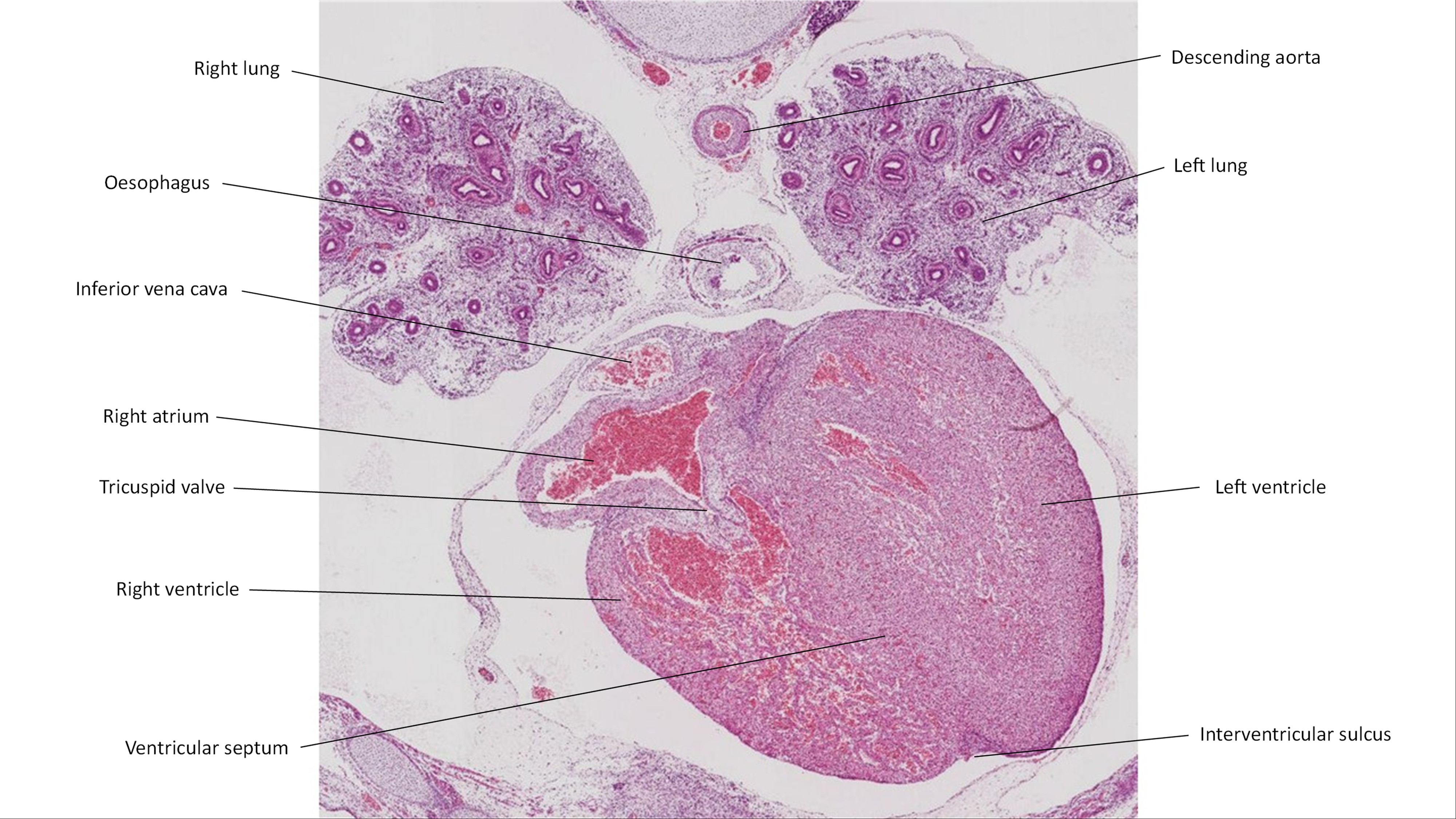 A histology section of a human embryo