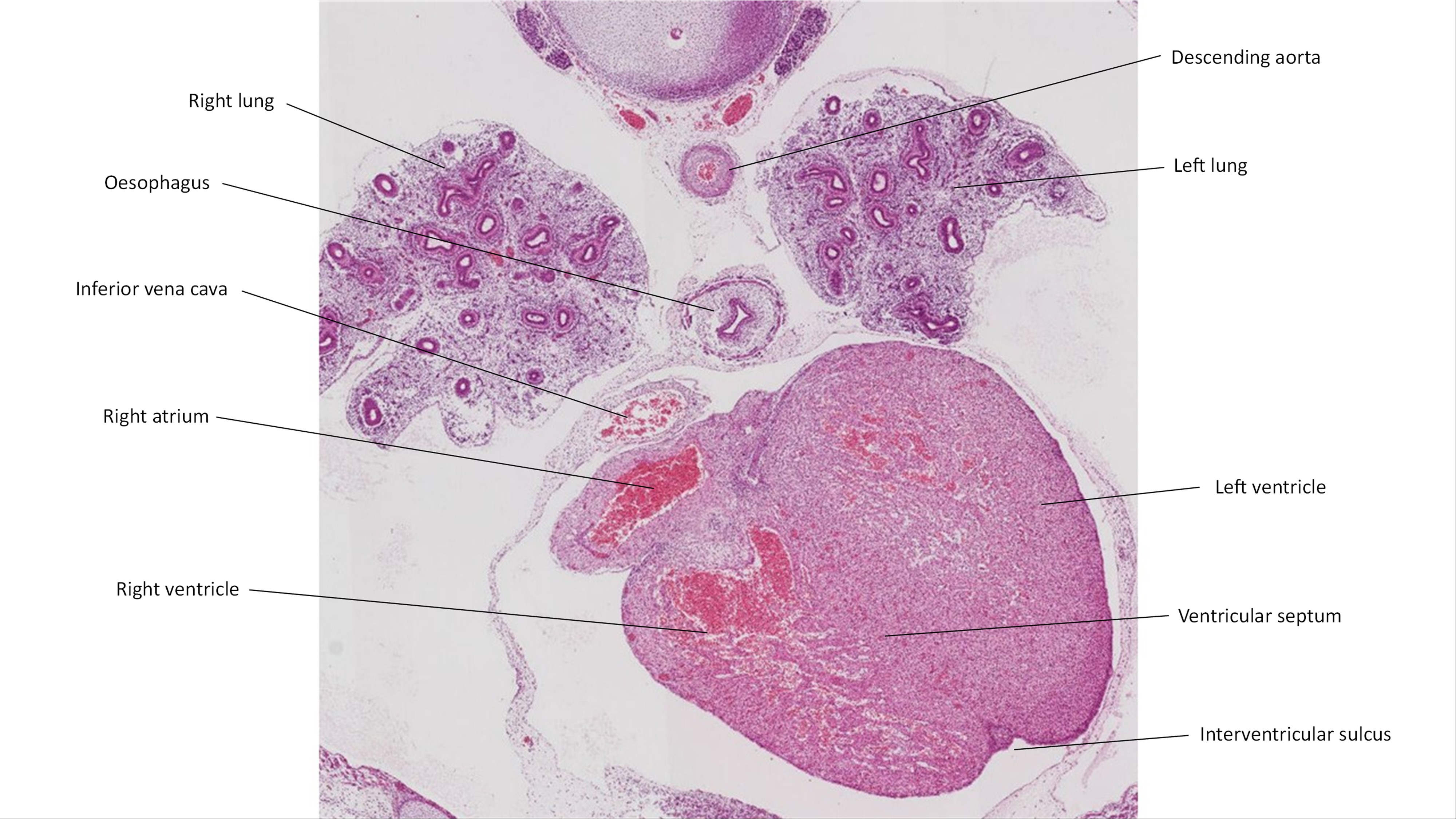 A histology section of a human embryo
