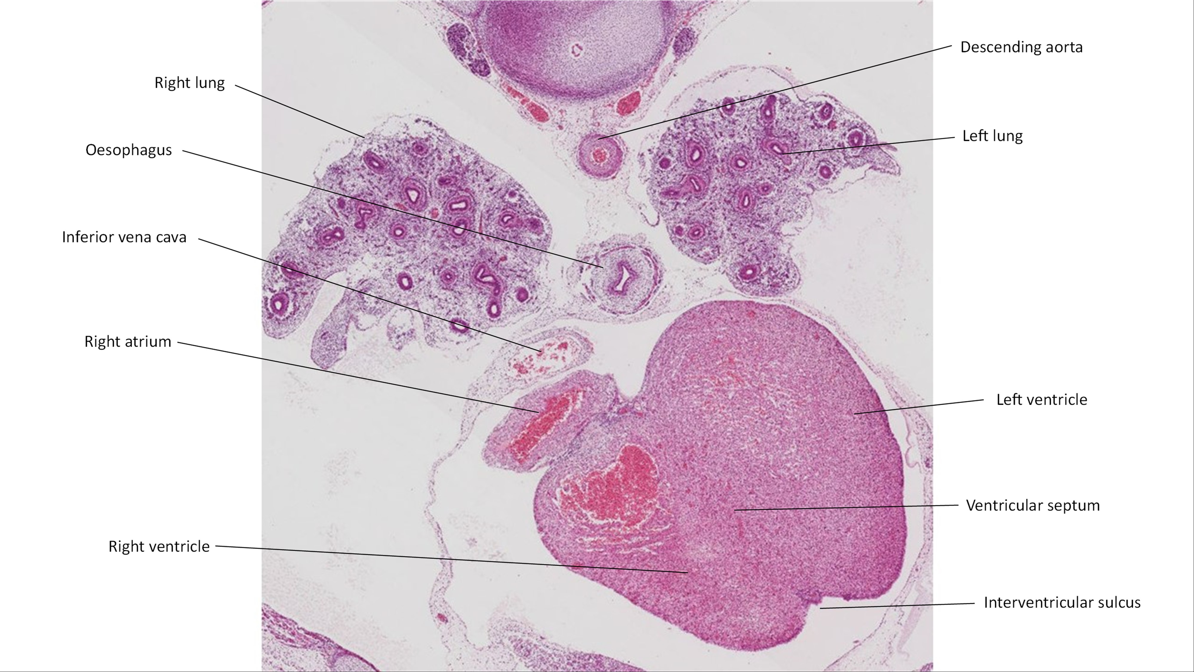 A histology section of a human embryo