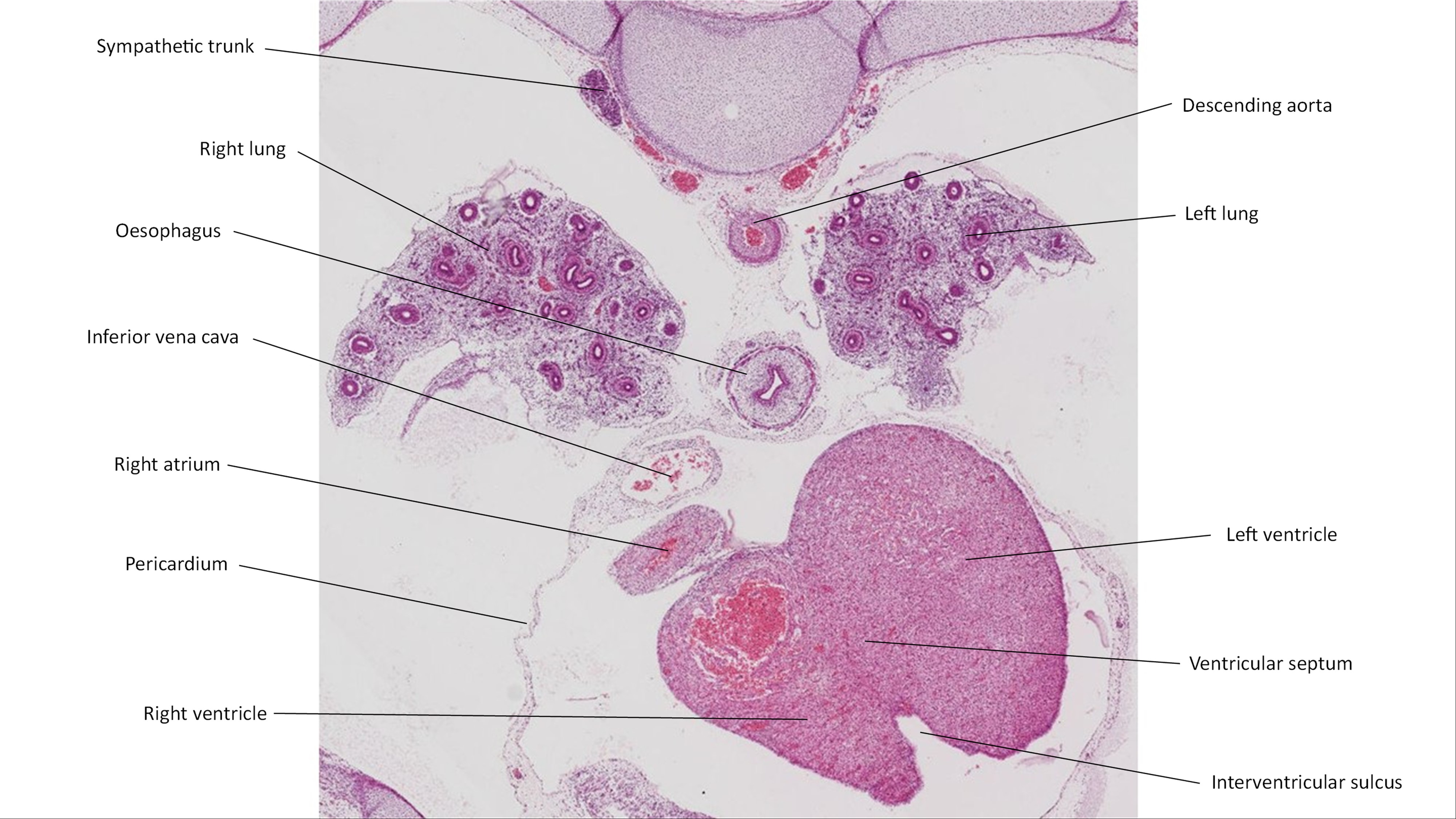 A histology section of a human embryo