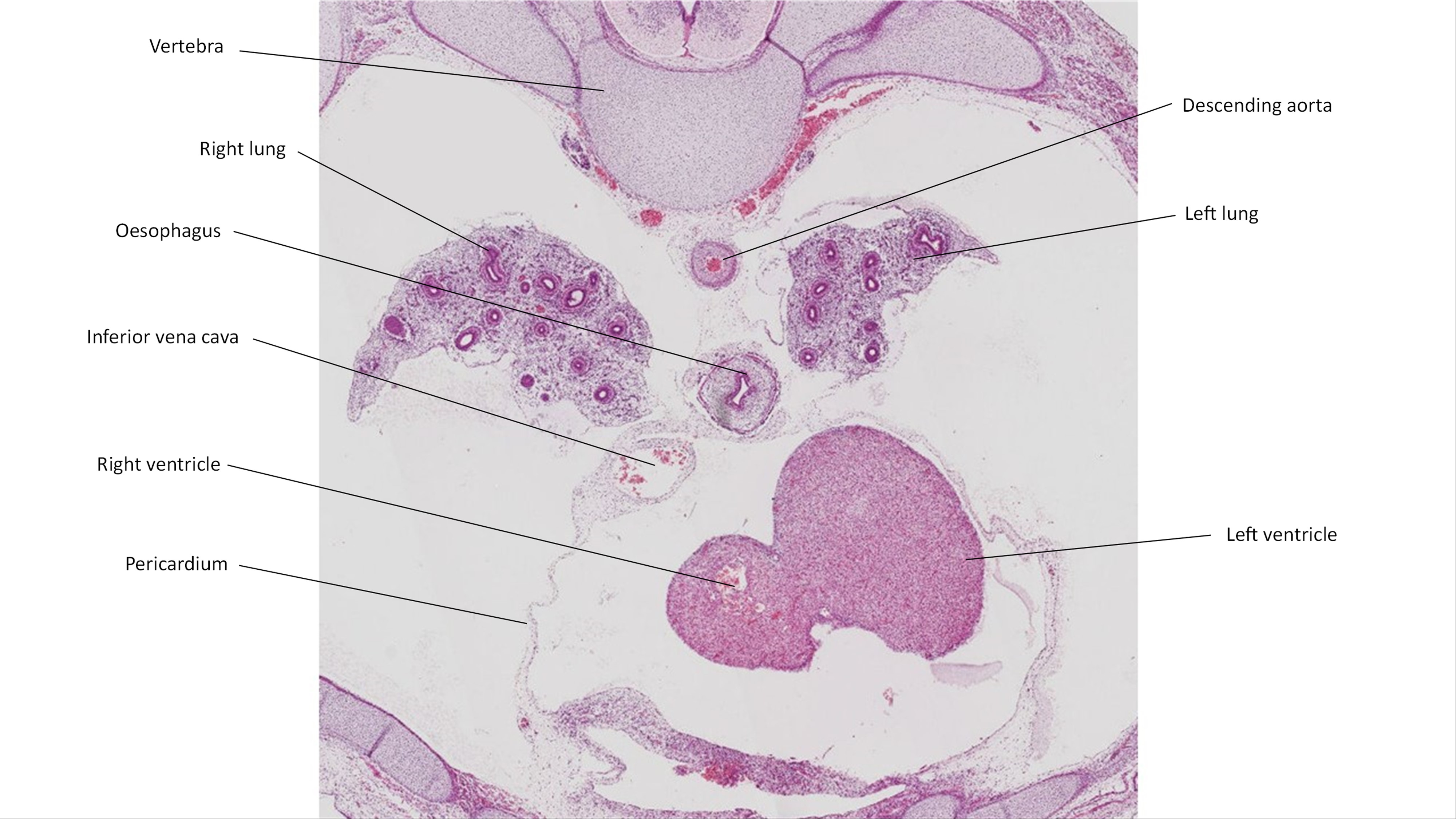 A histology section of a human embryo