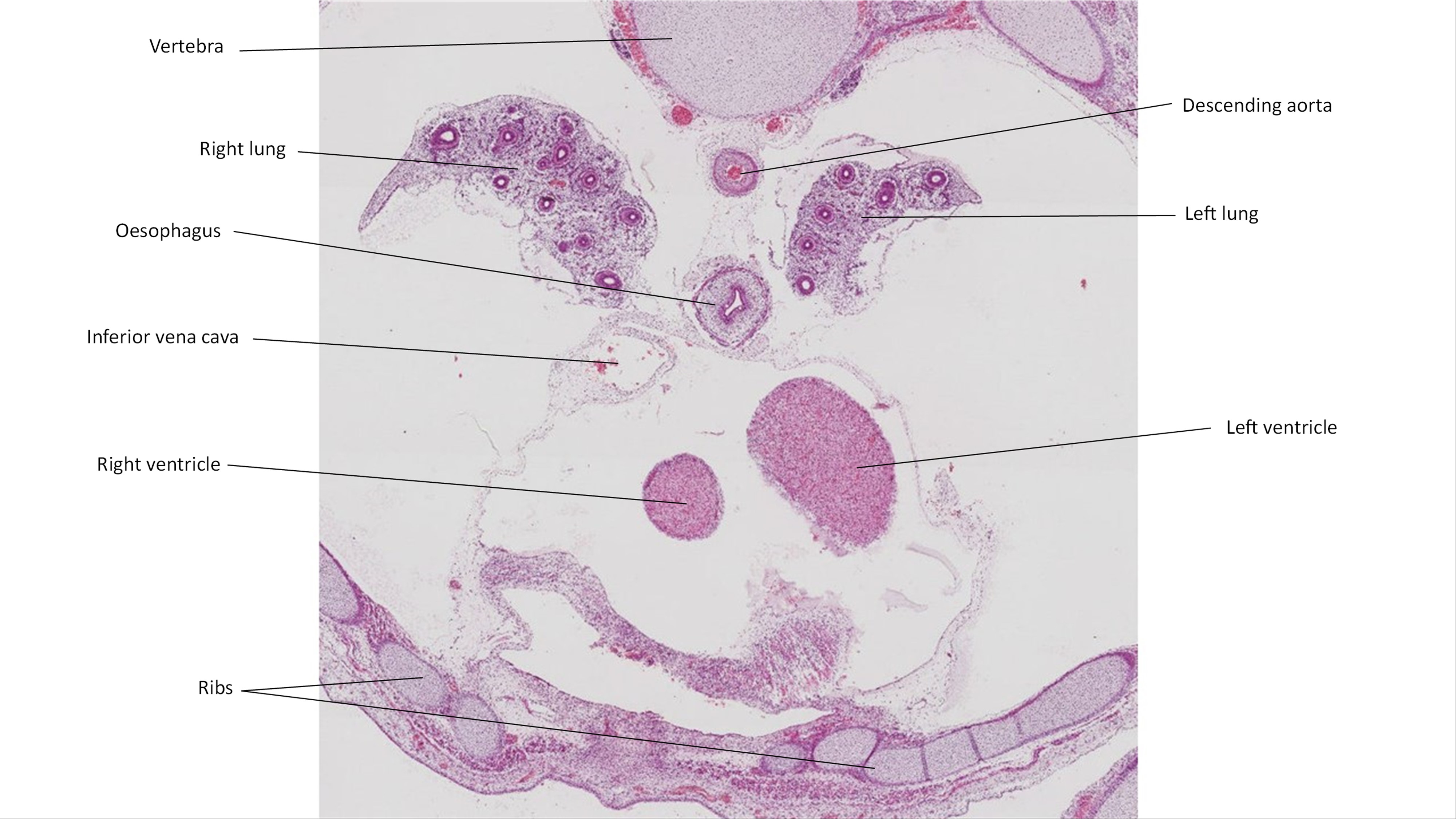 A histology section of a human embryo