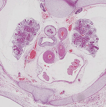 A histology section of a human embryo