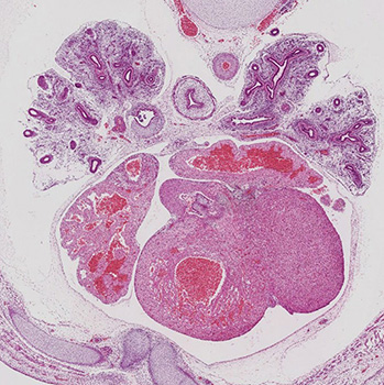 A histology section of a human embryo