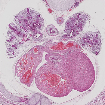 A histology section of a human embryo