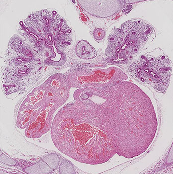 A histology section of a human embryo