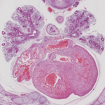 A histology section of a human embryo