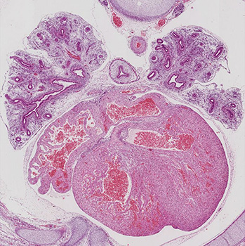 A histology section of a human embryo