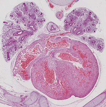 A histology section of a human embryo