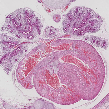 A histology section of a human embryo