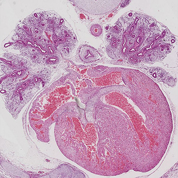 A histology section of a human embryo