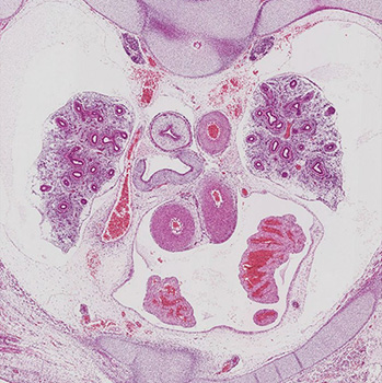 A histology section of a human embryo
