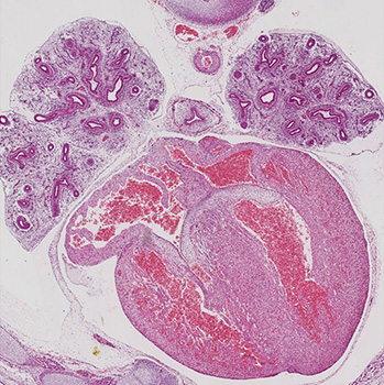 A histology section of a human embryo