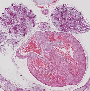 A histology section of a human embryo