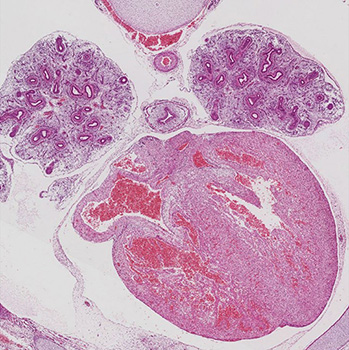 A histology section of a human embryo