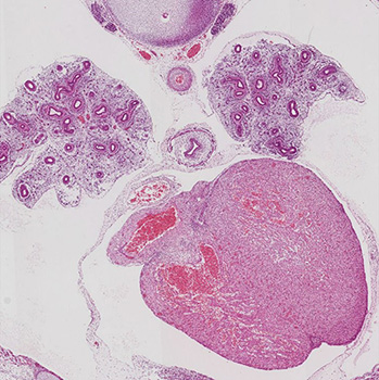 A histology section of a human embryo